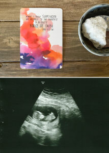 12 week baby ultrasound