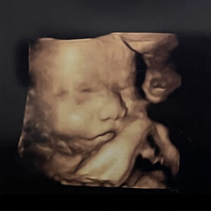 second trimester pregnancy update - pregnant at 40